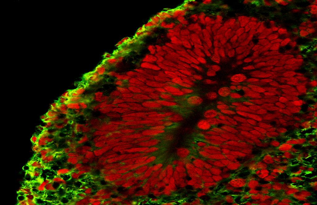 Organoids